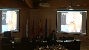 MIBE2015 - Casos en directo en el Madrid International Bariatric Endoscopy MIBE2015 - Casos en directo en el Madrid International Bariatric Endoscopy 20150925_162706