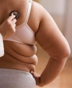 Los riesgos para los obesos en verano, en la Cadena Ser Los riesgos para los obesos en verano, en la Cadena Ser obesidad_pan